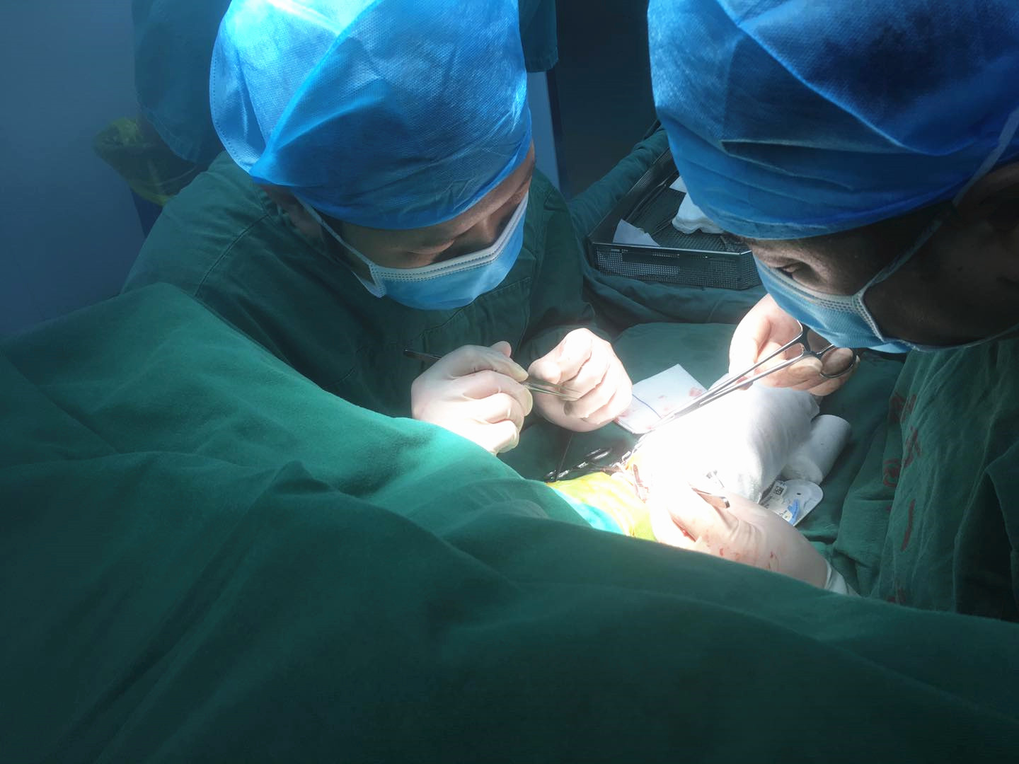 术中.jpg 术中.jpg