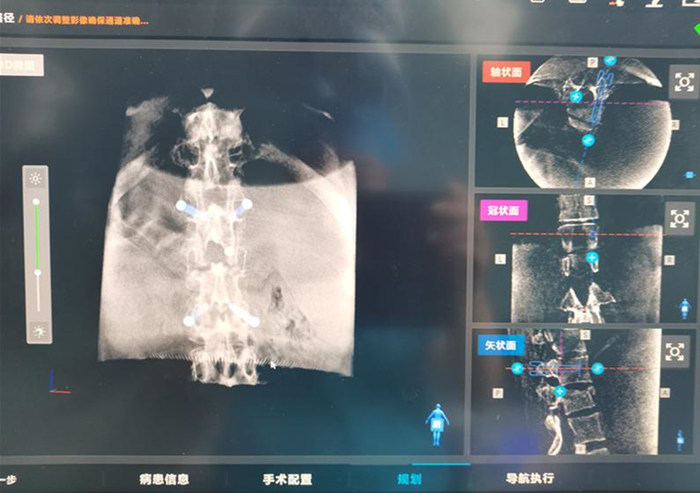 �? ���л����˶���׵�ö�·�߽��о�׼�滮_����.jpg