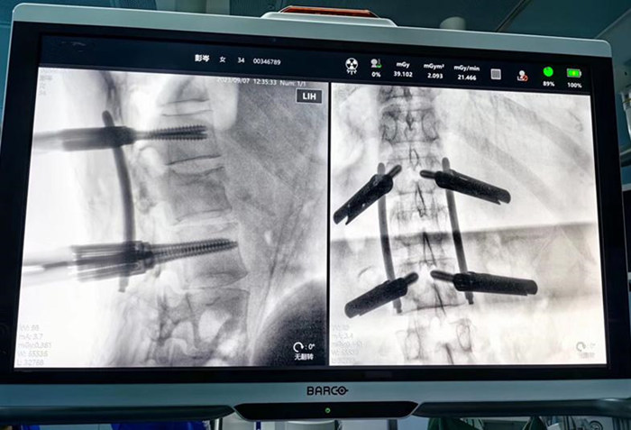 �? ����͸�Ӽ����۸�λ�������ݶ�λ������_����.jpg