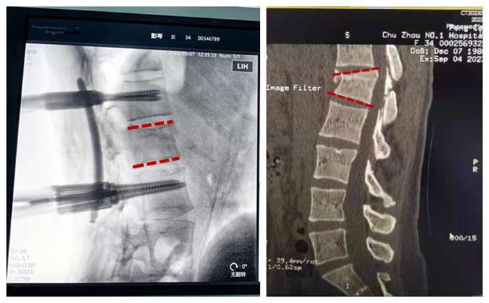 �?  ��������ǰ׵��߶ȼ���͹�����Աȣ���Ч����_����.jpg