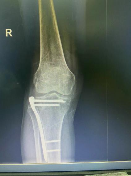 �?����ͳ�ڹ̶��ְ��?- ����.jpg